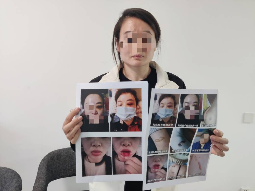 足球波胆
_郑州一女子被企业家丈夫家暴最新进展：已要回孩子抚养权