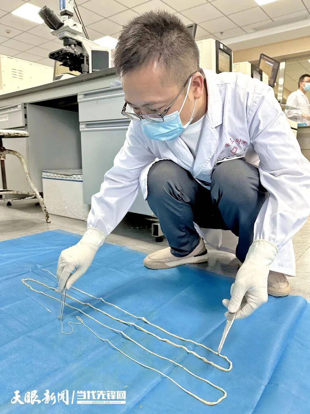 山口雷法 vs 千叶市原_最长4米！贵州一男子连续7个月排出“面条状异物”山口雷法 vs 千叶市原，医生：很可能和吃这种生食有关