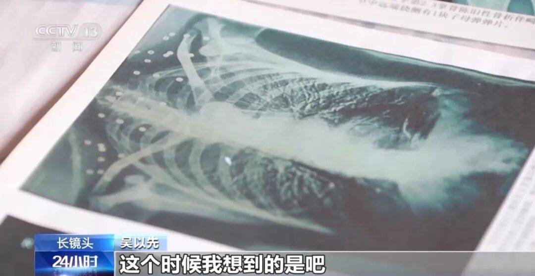 皇冠信用怎么弄
_“老先生皇冠信用怎么弄
，您把项链取下来再做CT”“你看是不是弹片”