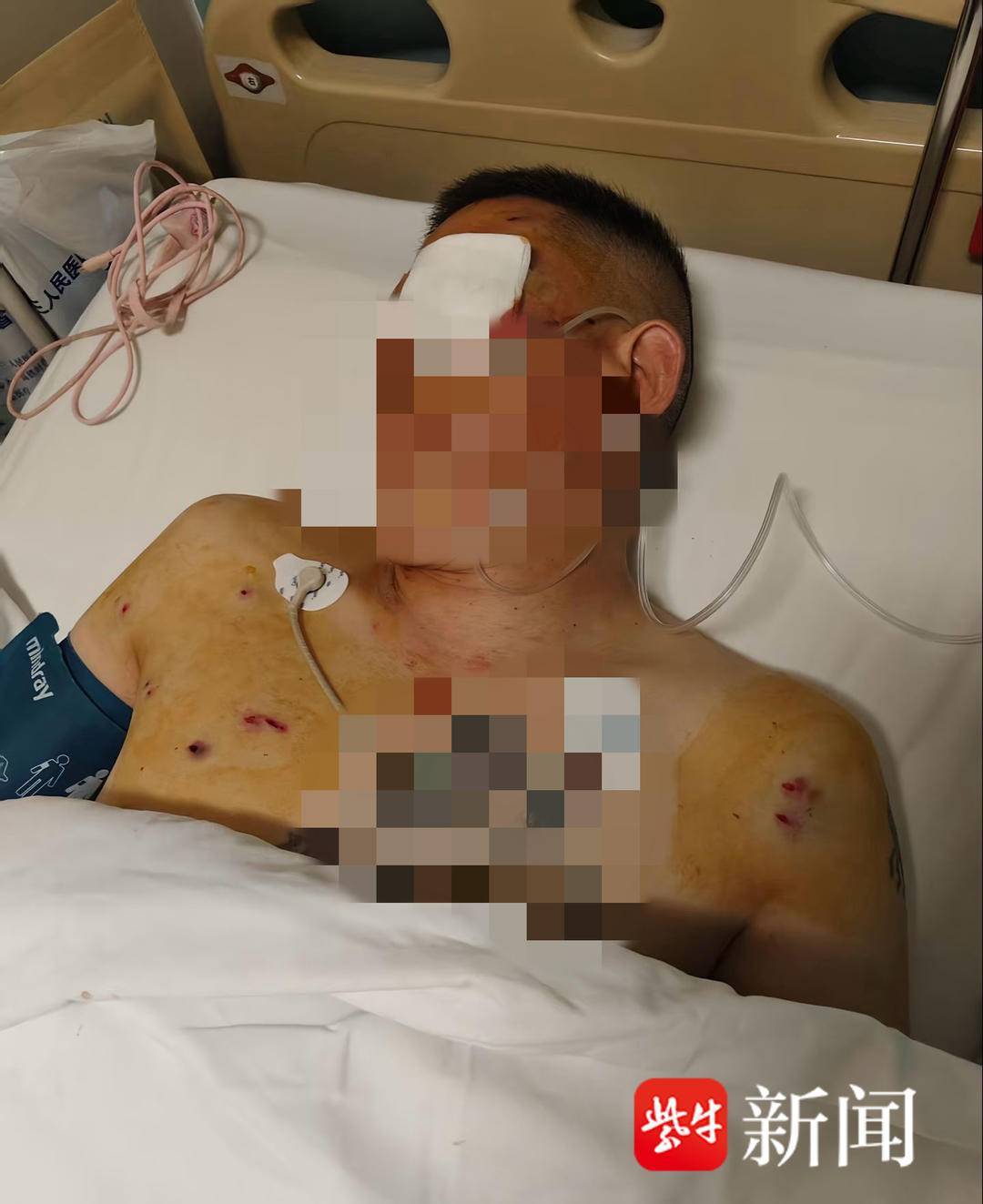 排球
_紫牛头条｜男子取款170万在银行门口遭抢劫致重伤排球
，当事人认为银行保安未帮忙应担责